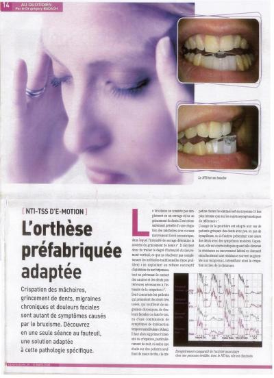 Bruxisme,Dr gregory badach, dentiste Paris 5 (5ème)